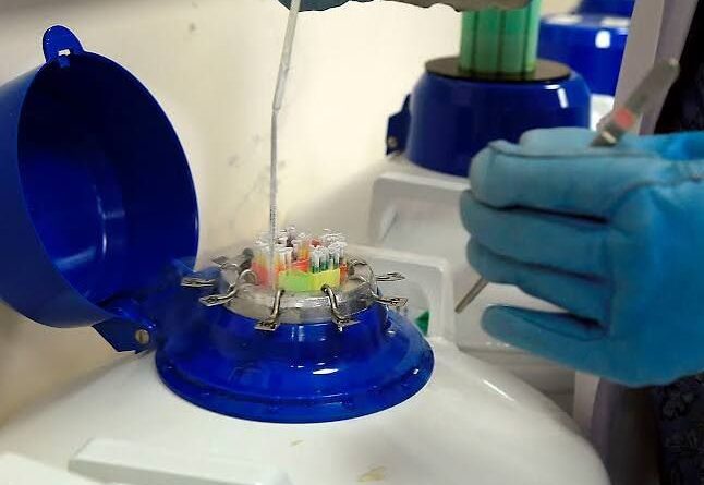 Un estudio relaciona la contaminación ambiental con las diferencias en la fertilidad masculina entre regiones foto fertilidad masculina afectada por contaminación